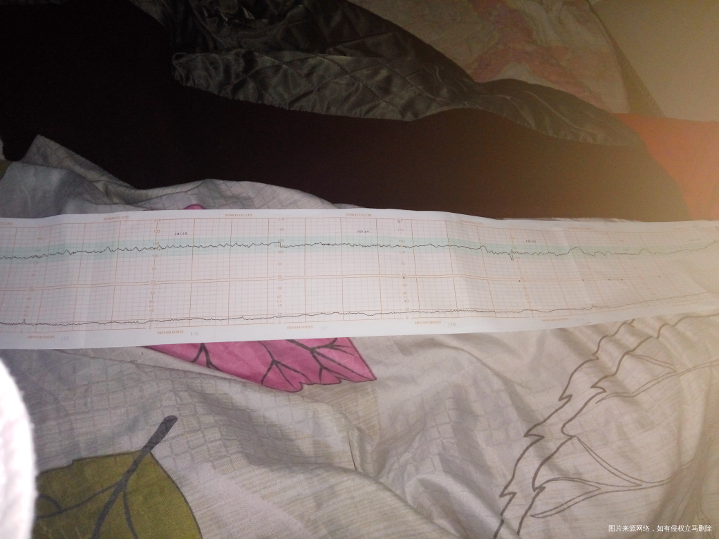 在线医生帮我看下,谢谢