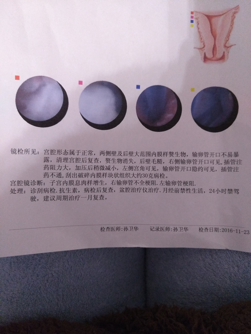 今天做宫腔镜了。希望能帮助那些快要做的人 难孕治疗圈 好孕帮