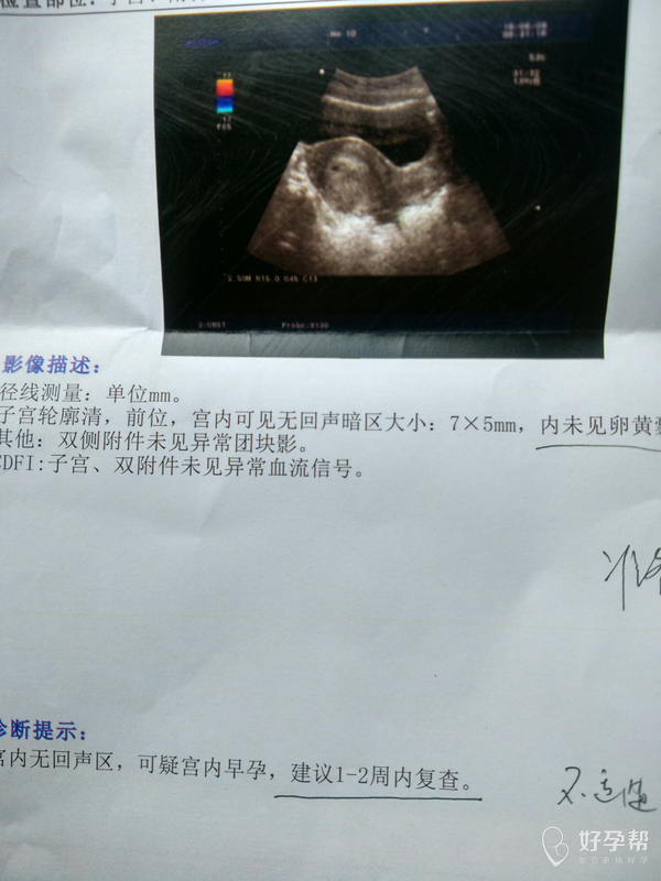 今天照彩超了,各位宝妈知道是不是宫外孕麽?
