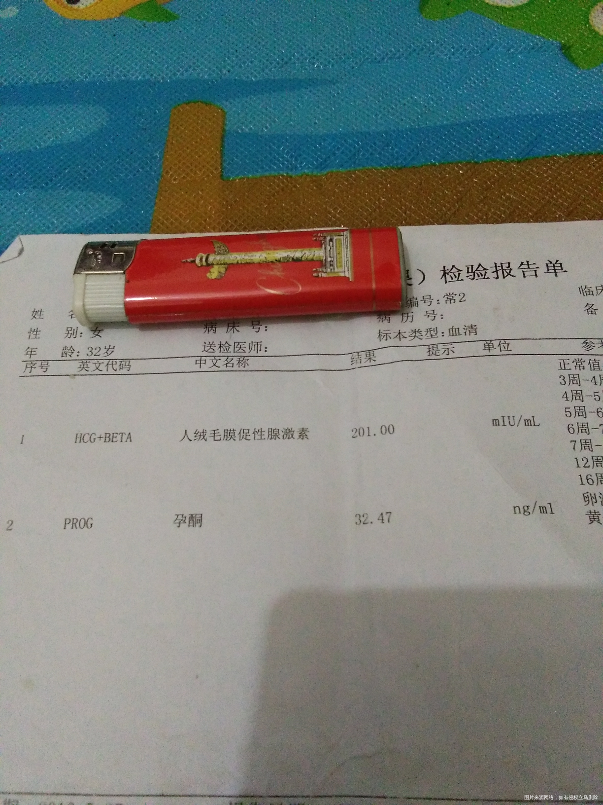 【我的孕期分享】不省心的二胎宝贝