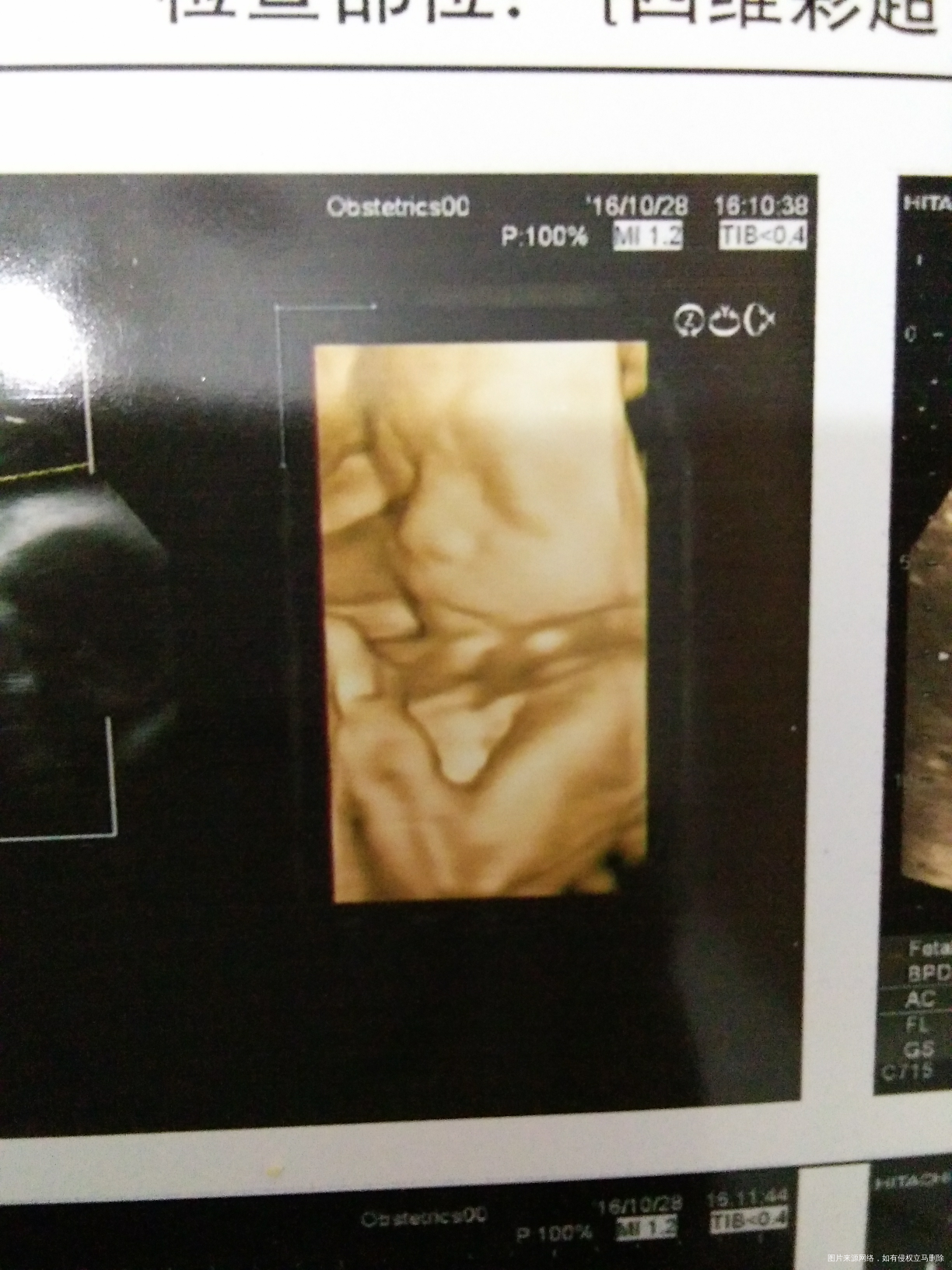 【我的孕期分享】不省心的二胎宝贝