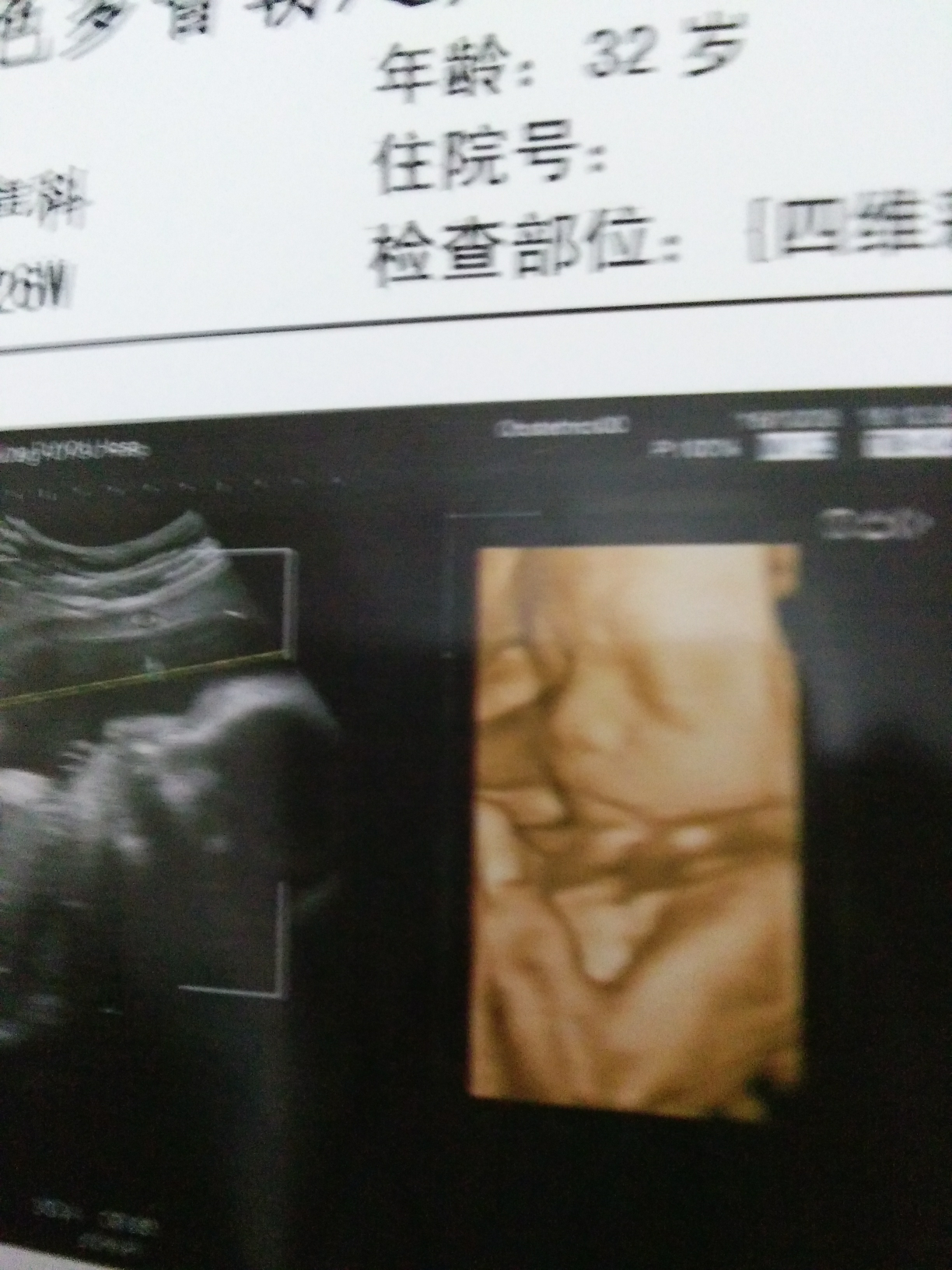 【科学备孕】我意外到来的二胎宝贝