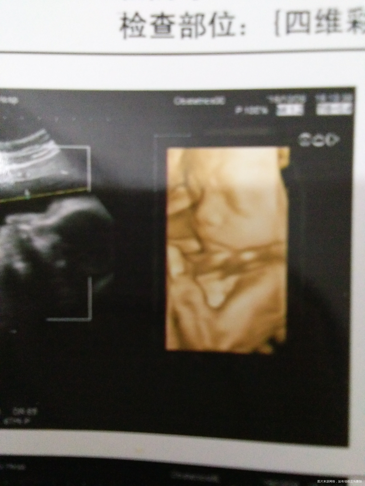 宝宝超级配合,四维超快一次通过