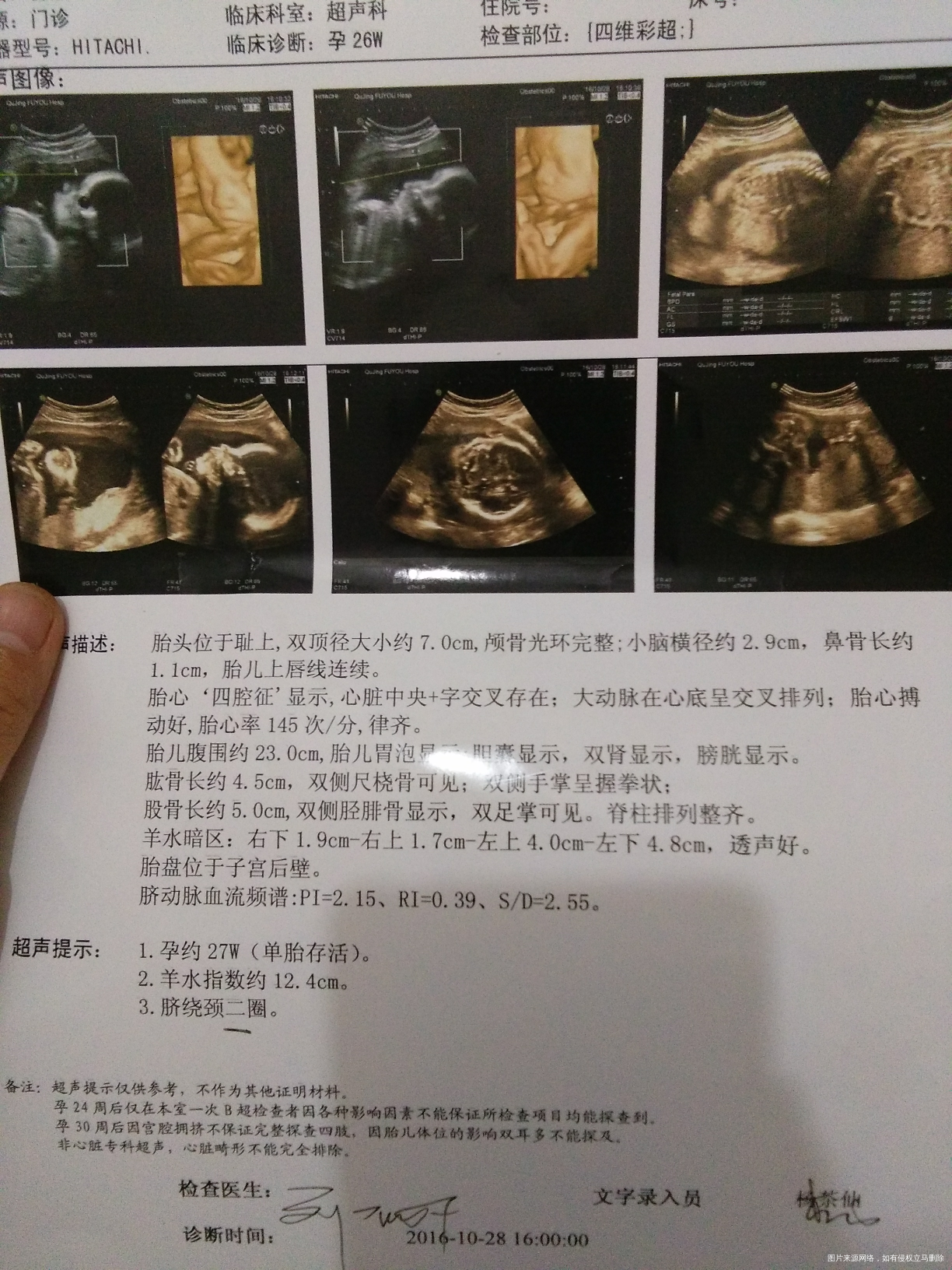 【我的孕期分享】不省心的二胎宝贝