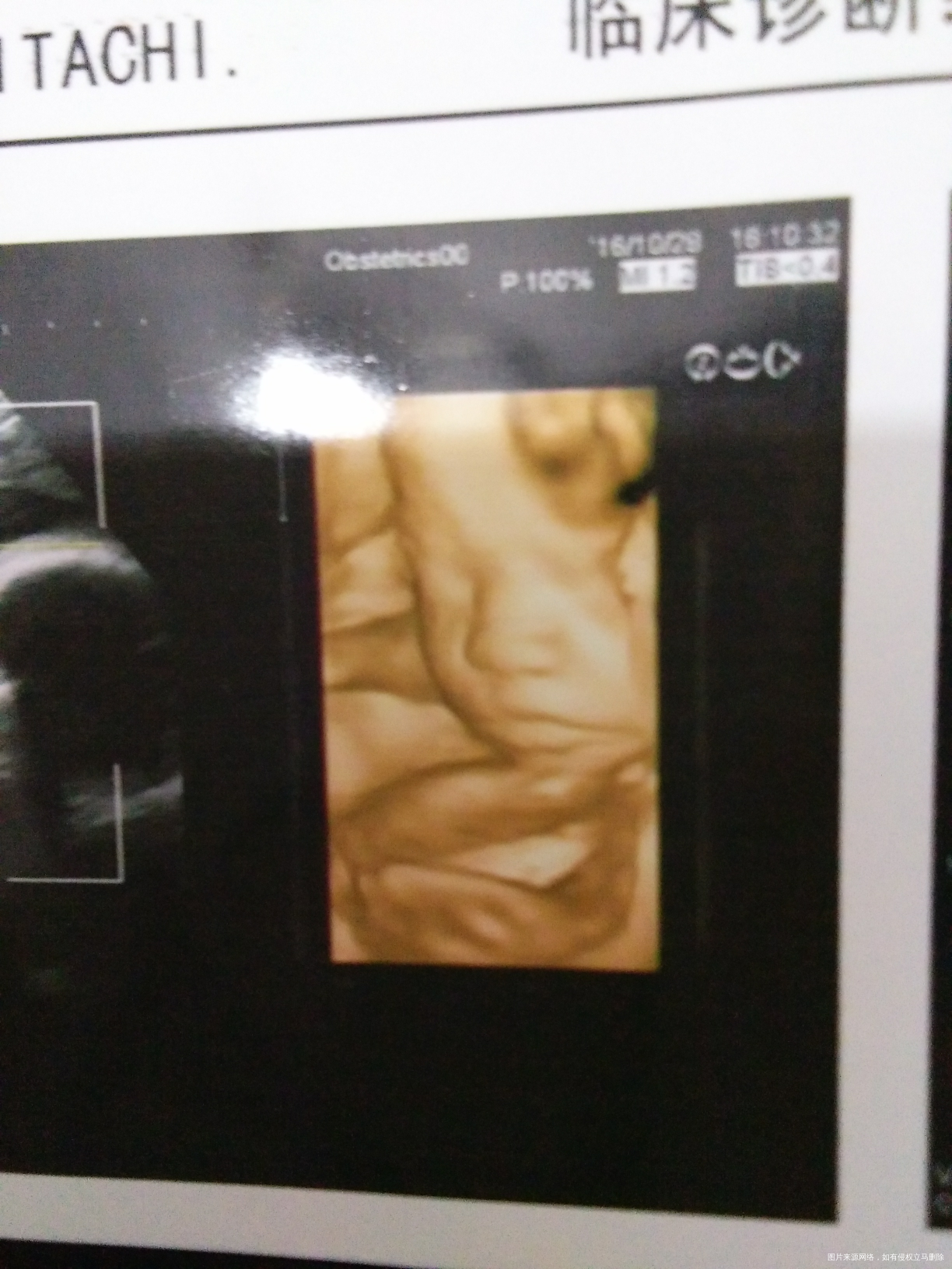 宝宝超级配合,四维超快一次通过