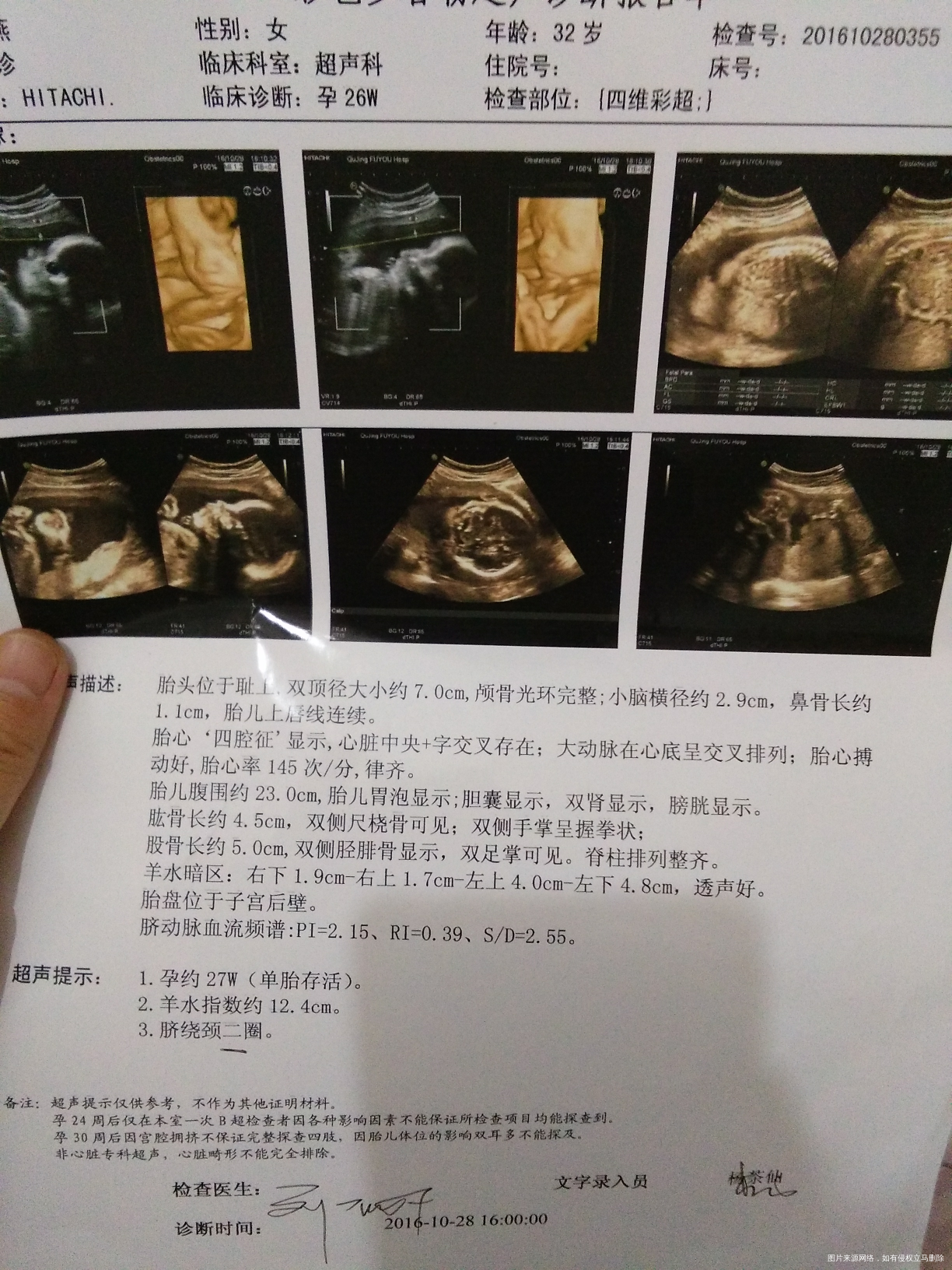 宝宝超级配合,四维超快一次通过