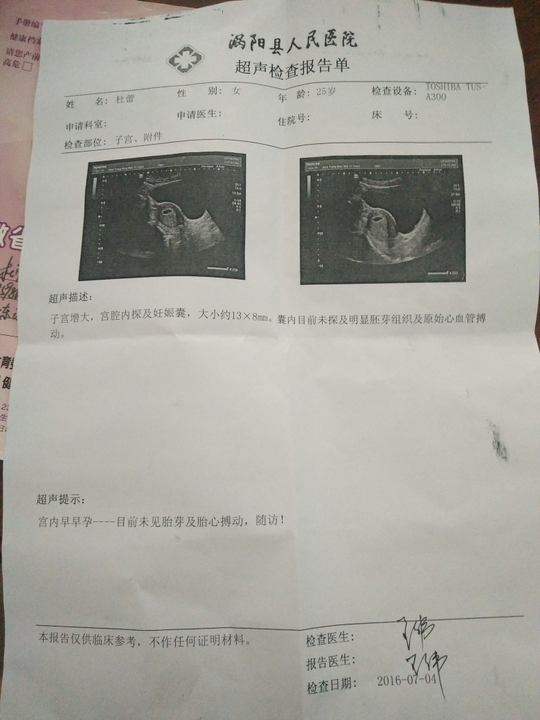 怀孕45天去做彩超,好害怕啊