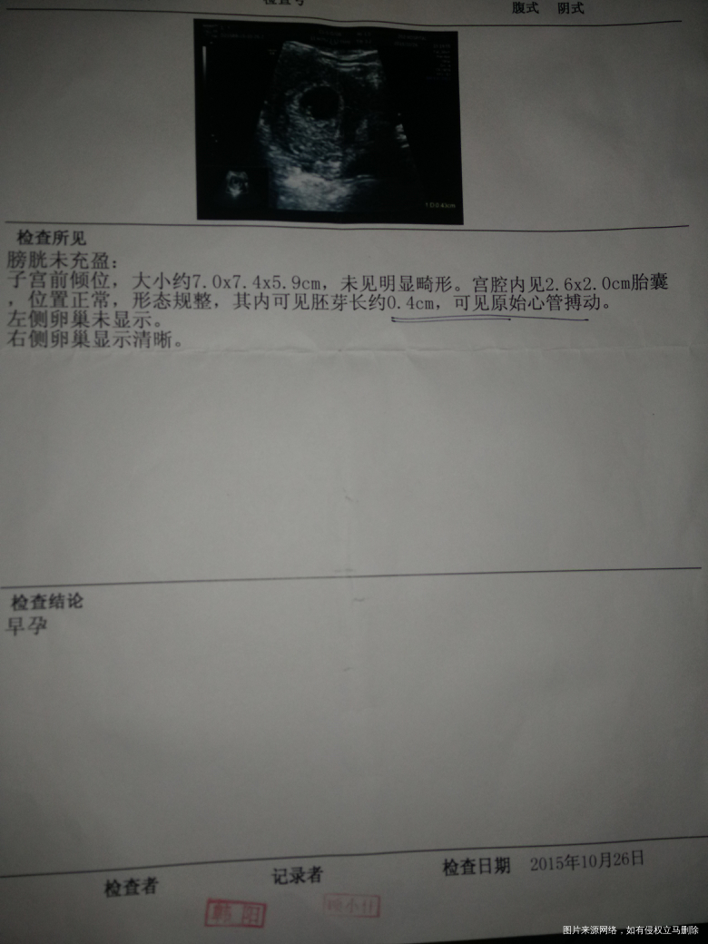 【我的孕期分享】+点点滴滴的记忆