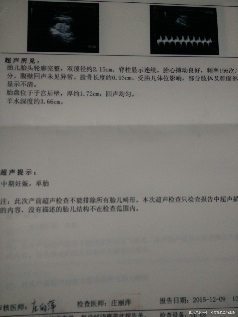 【我的孕期分享】+点点滴滴的记忆