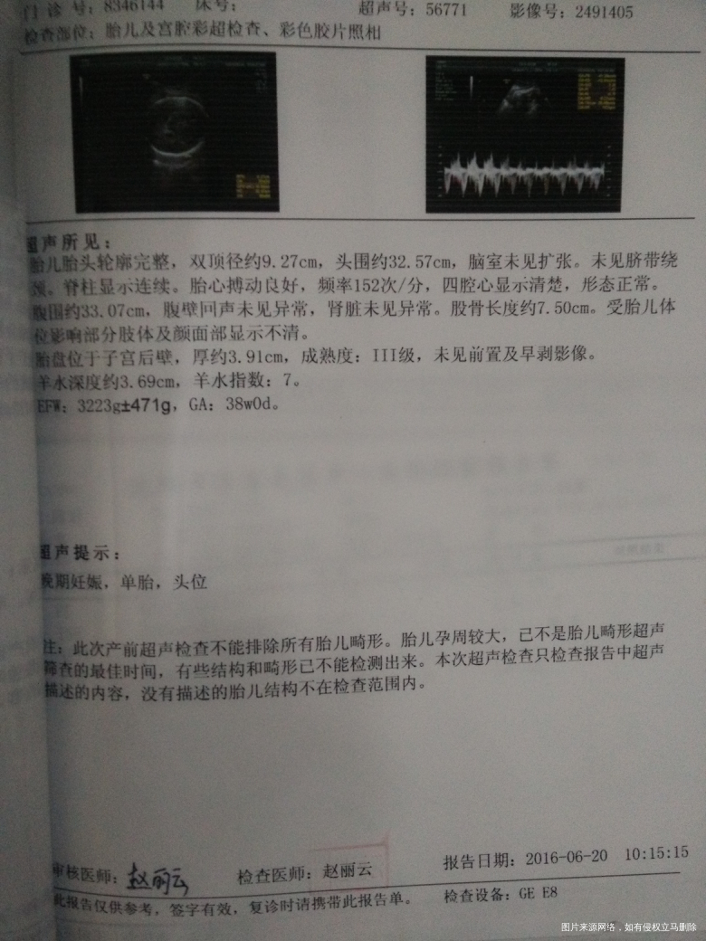 【辣妈体验】回忆生女经历