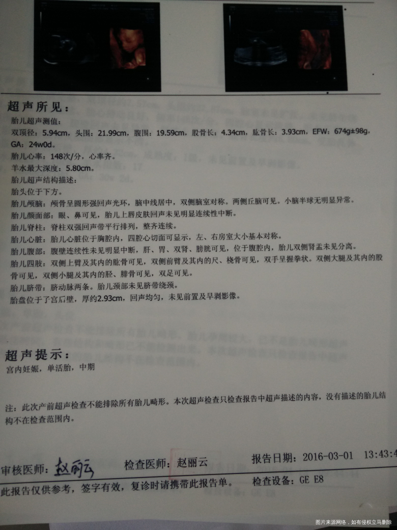 【我的孕期分享】+点点滴滴的记忆