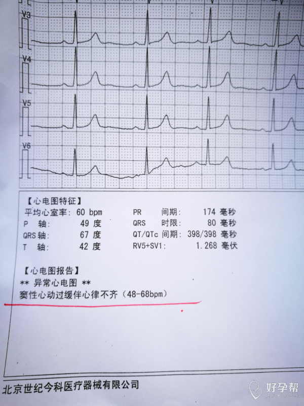 心率不齐加缓慢～凑字