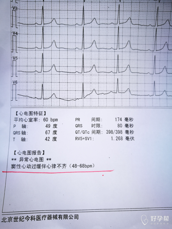 今天满12周产检做的心电图有点异常  有知道的医生吗?这种情况严重吗?