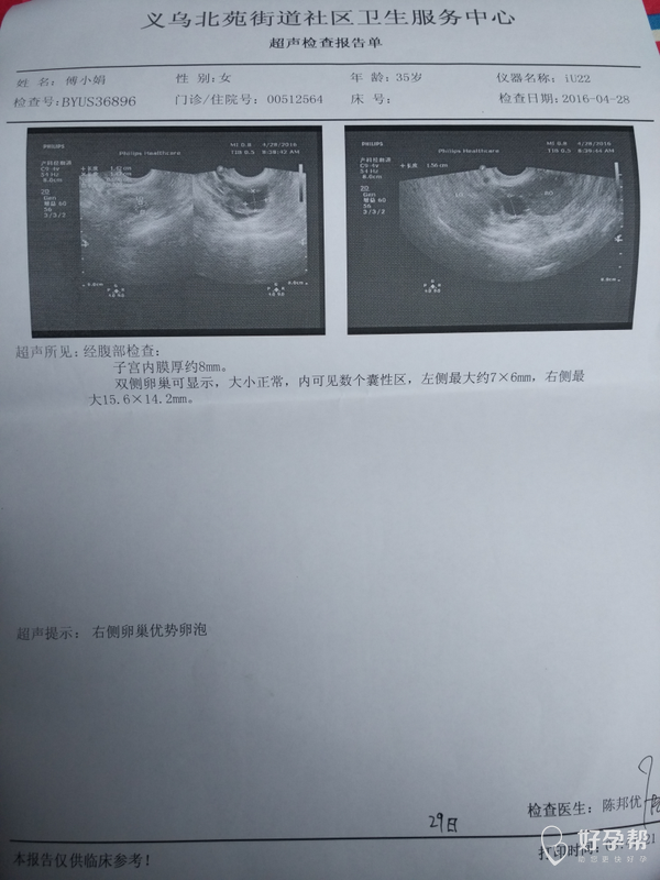 刚做了监测卵泡图今天晚上同房还是明天同房好