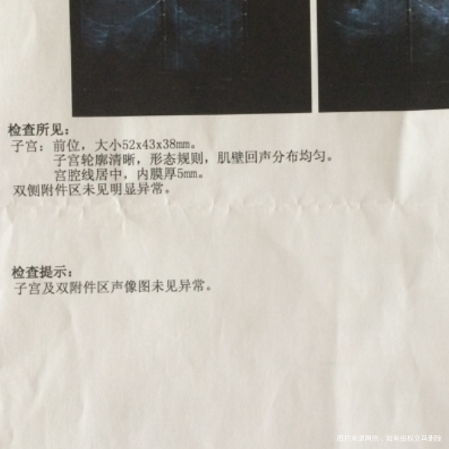 这能看出来有炎症吗