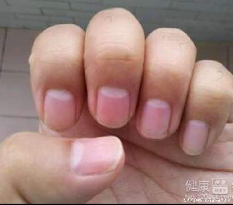 是真的吗?