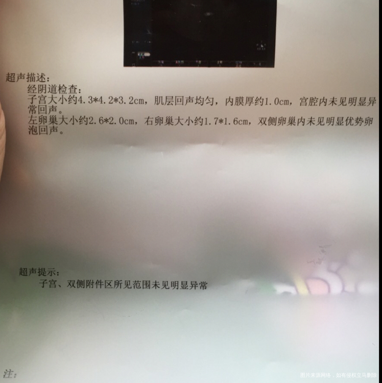 测出强阳 B超监测没有优势卵泡 怎么回事!