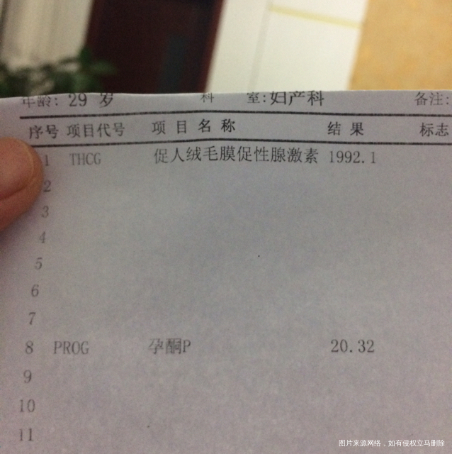 怀孕了,35天做B超能看到孕囊吗?
