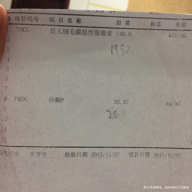 怀孕了,35天做B超能看到孕囊吗?