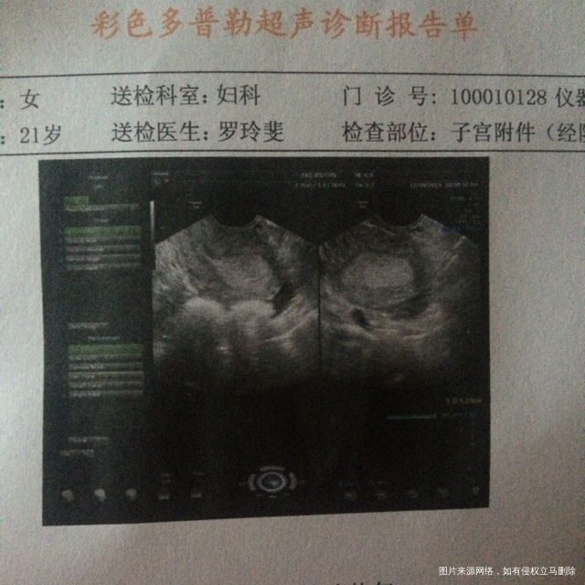 我的天啊 不知道怎么跟老公说了