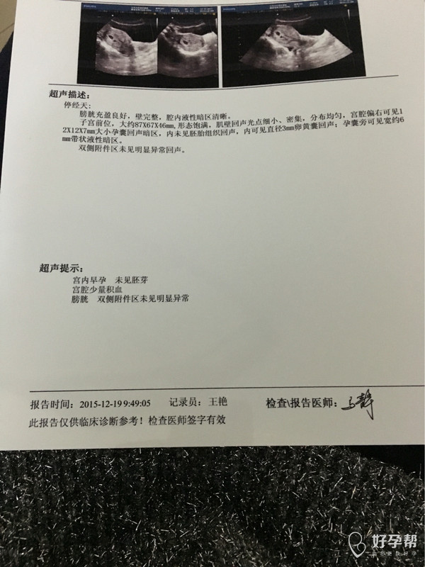 怀孕42天b超回来确定宫内但是未见胎心胎芽