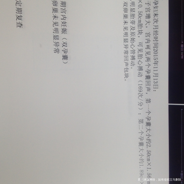 🈶️没姐妹懂的。求解?