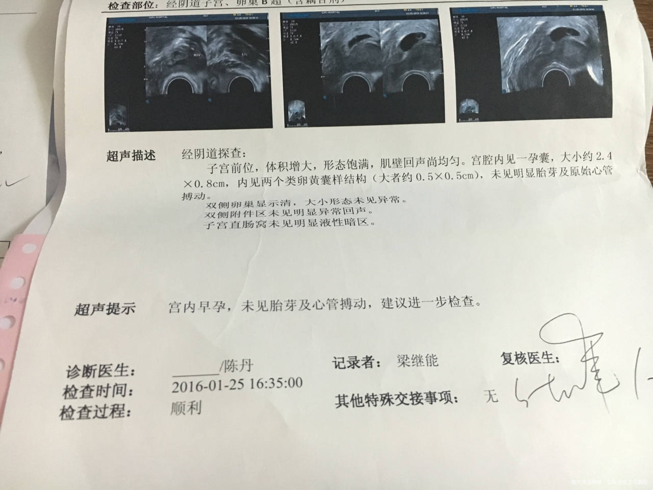今天医生跟我说别留着宝贝