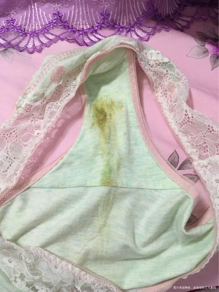 白带怎么这么黄,是不是炎症???