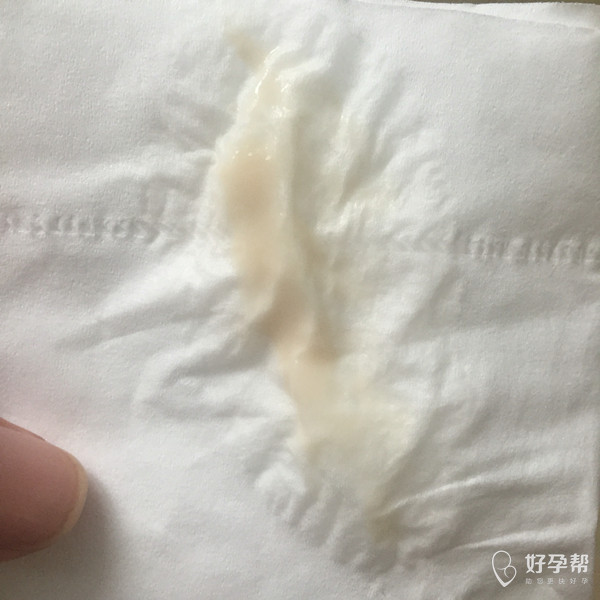 孕35天,粉色白带怎么办啊?hcg2683,孕酮87