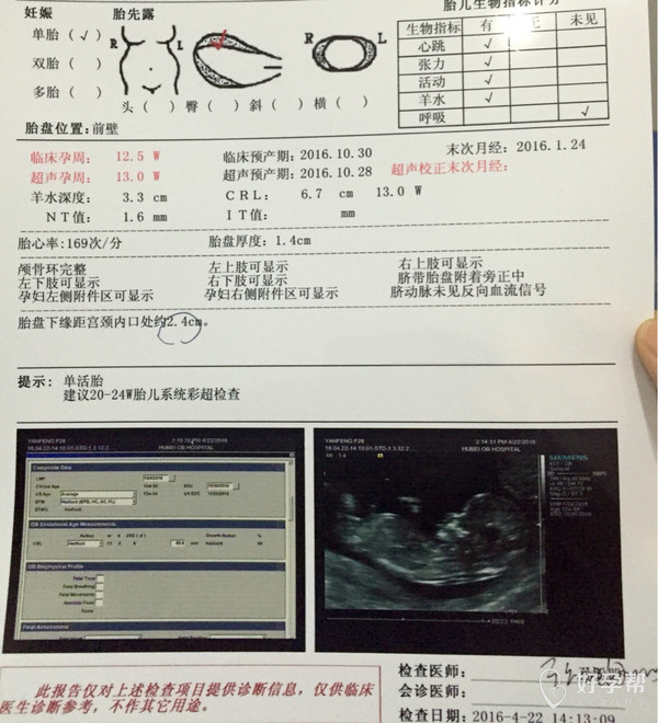 nt检查归来,b超单附上给大家参考