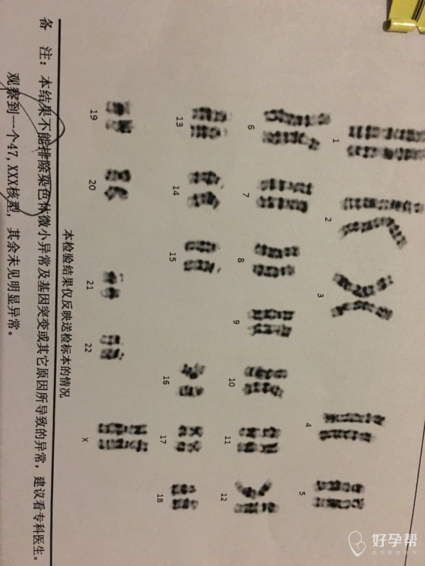 染色体异常有懂的亲帮忙看看
