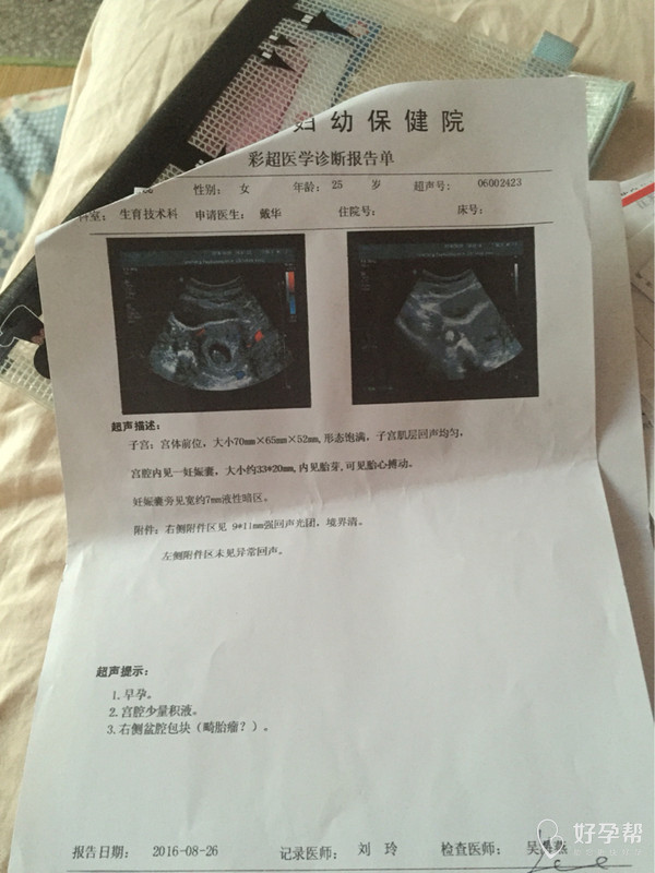 怀孕60天了今天复查b超宫腔少量积液,有宝妈能碰的过吗?严重吗?