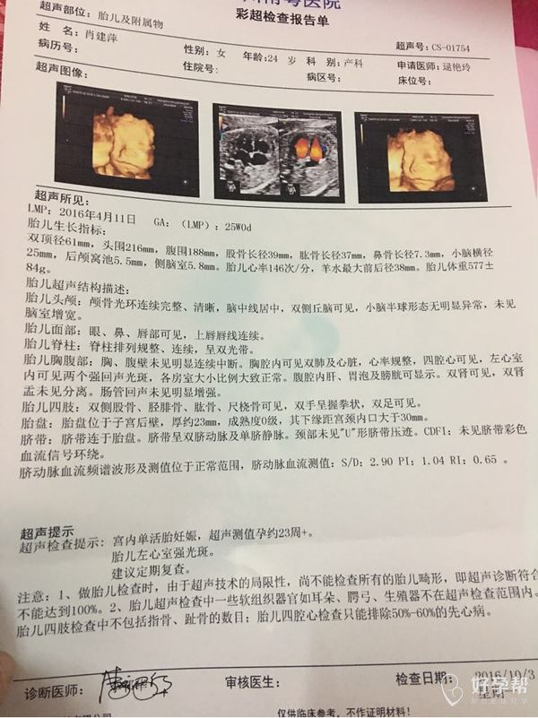 四维彩超归来能看出男女吗大家有经验来看看00