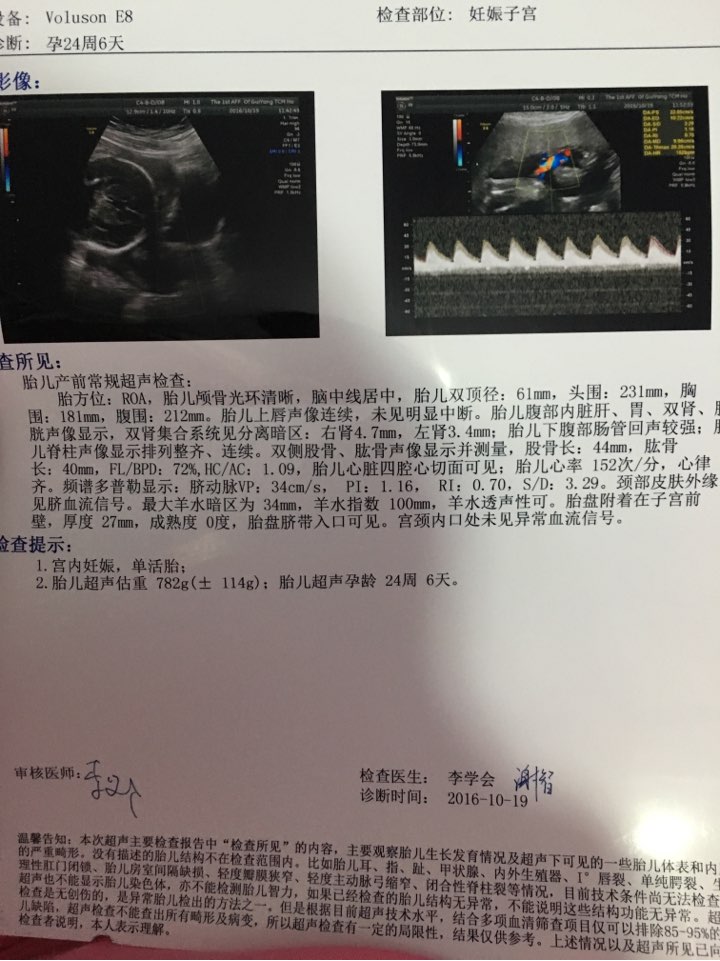 胎儿颈部皮肤外缘见脐血流信号