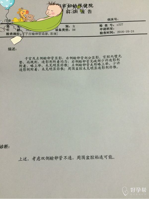 双侧输卵管不通盆腔粘连可能