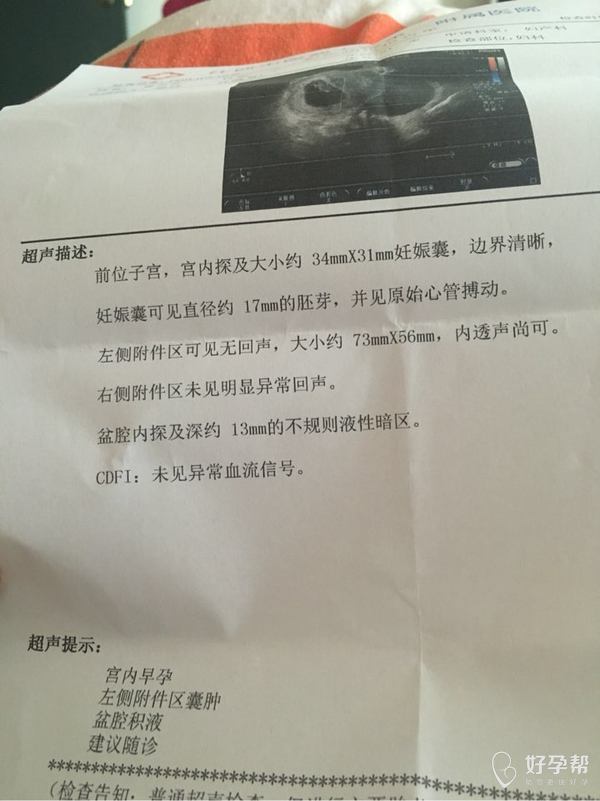 刚刚照的b超,医生说左侧附件有个好大的囊肿,会影响胎儿发育嘛?