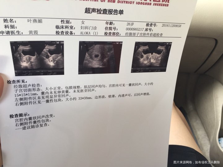 求助医生看结果,急急急,,,