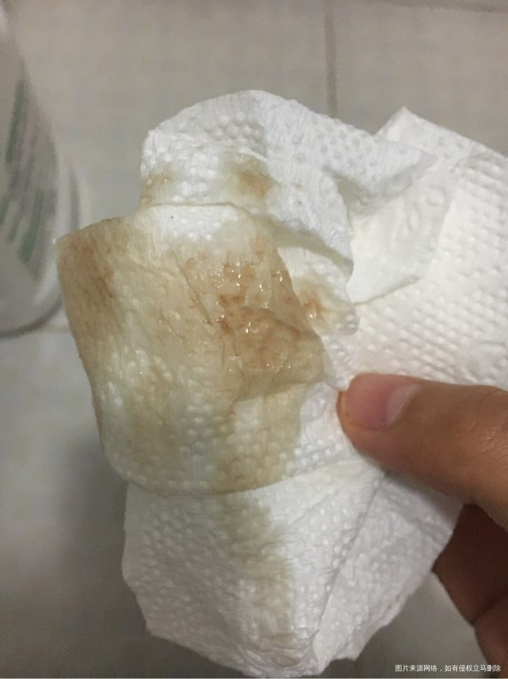 麻烦医生帮忙看看 这究竟怎么回事