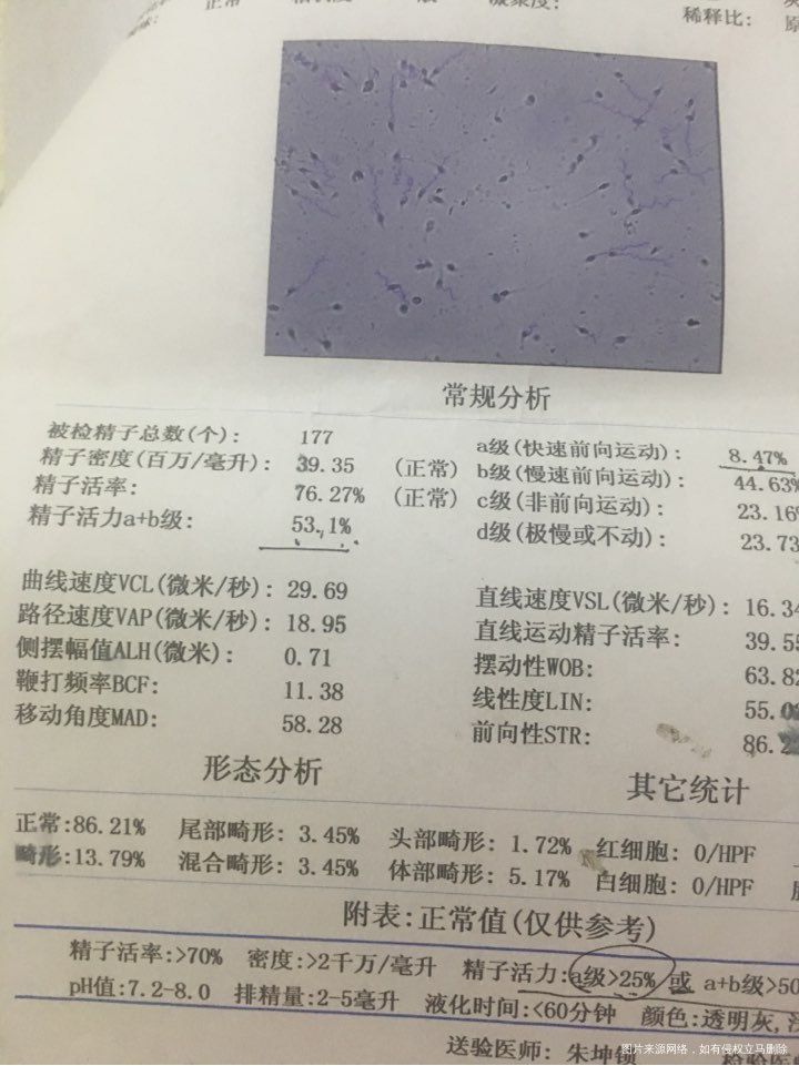 请求医生帮忙看看,这样的精子能要上小孩吗