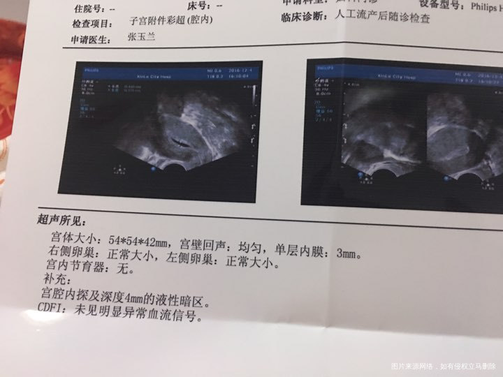 自然流产第七天了今天照的彩超