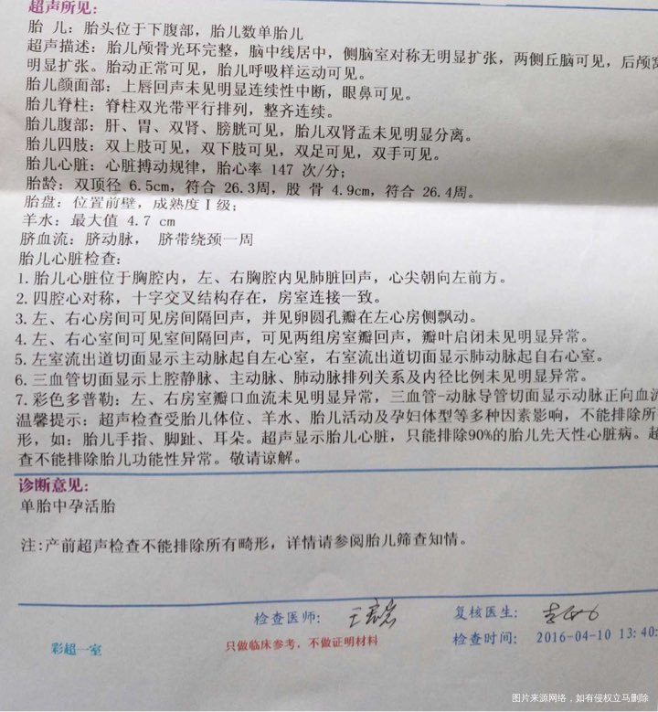 宝宝太给力了,四维怎么可以这么快就通过了呢!