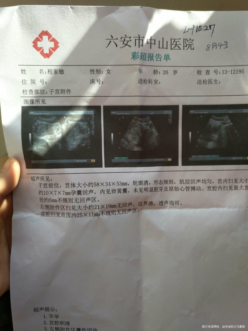 怀孕四十天,,昨天坐车回来发现白带有粉红褐色怎么办