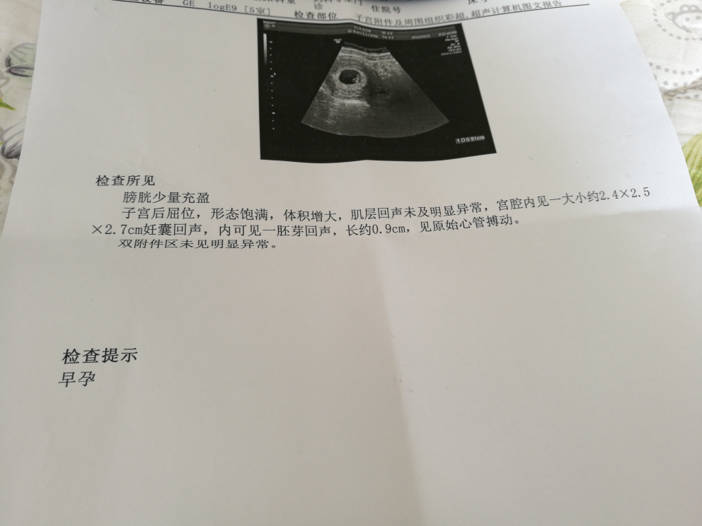孕七周,第一次b超,是有胎心胎芽吧