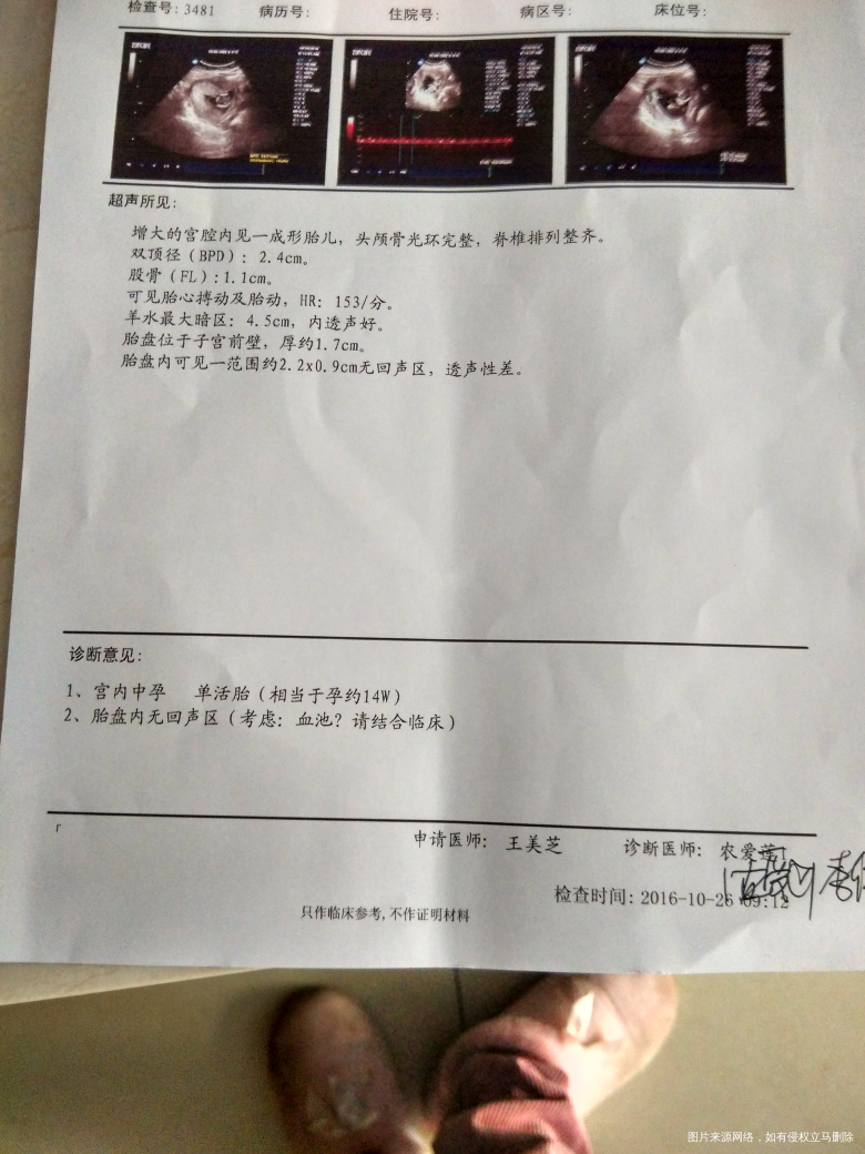 求医生帮忙看看羊水18周比14周变少怎么办