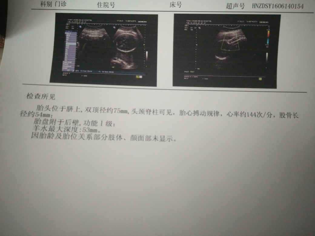 29周的男宝宝b超图……-孕前检查-孕前检查-好孕妈妈论坛-好孕帮