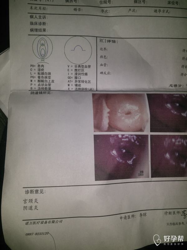 今天白带特别多裤子都是湿的,已经有很好个月了,上个月去检侧说是宫颈