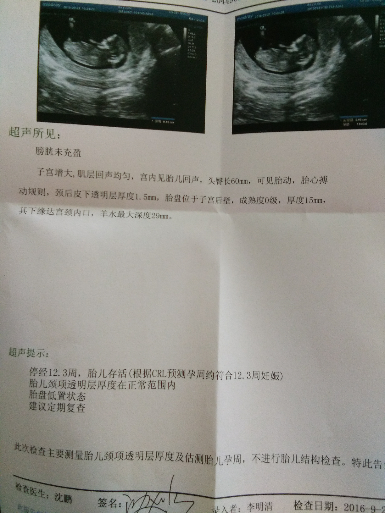 求助 胎盘低置是什么意思