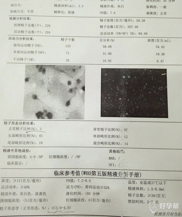 老公精子正常比例低,影响怀孕吗