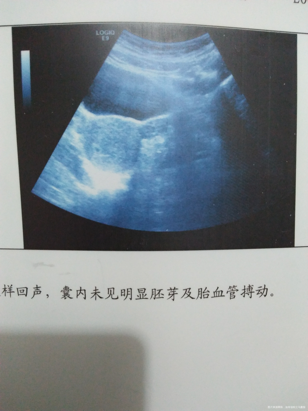 帮我看看吧, 帮我看看,谢谢了,在线坐等回复