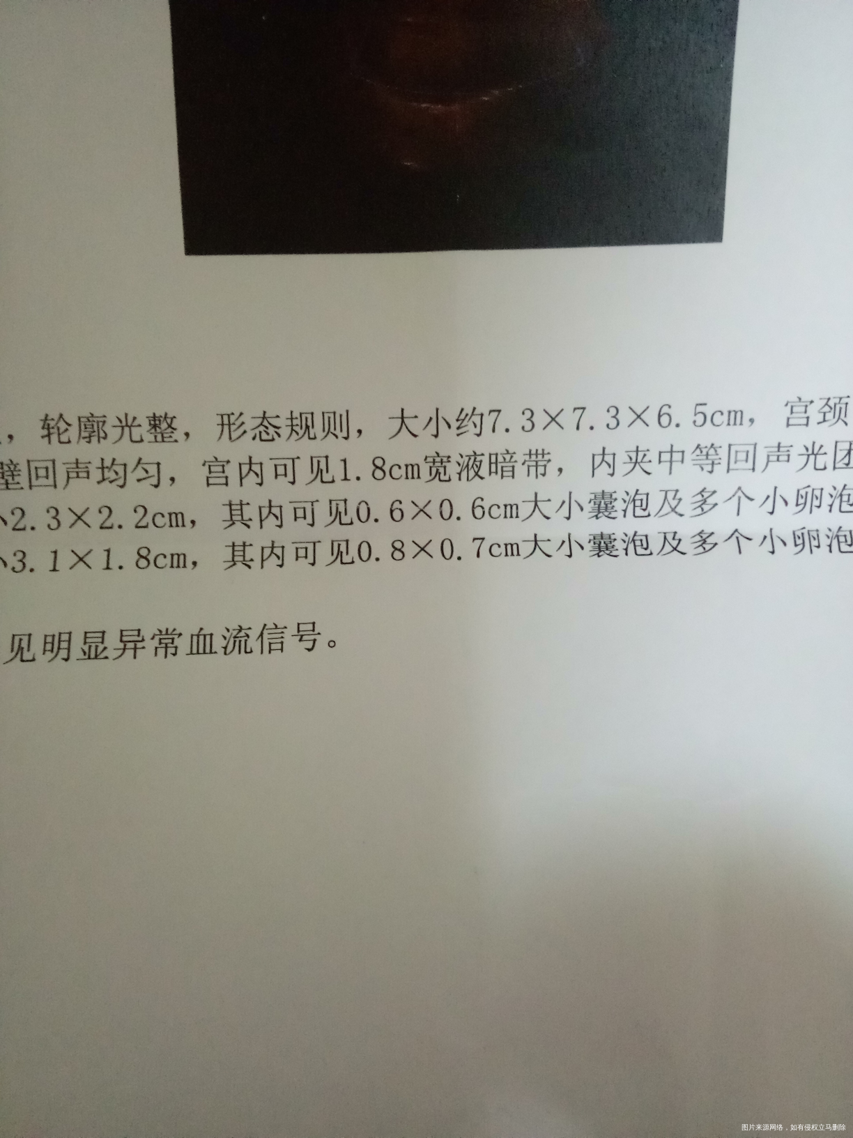 请问引产后多久可以清宫